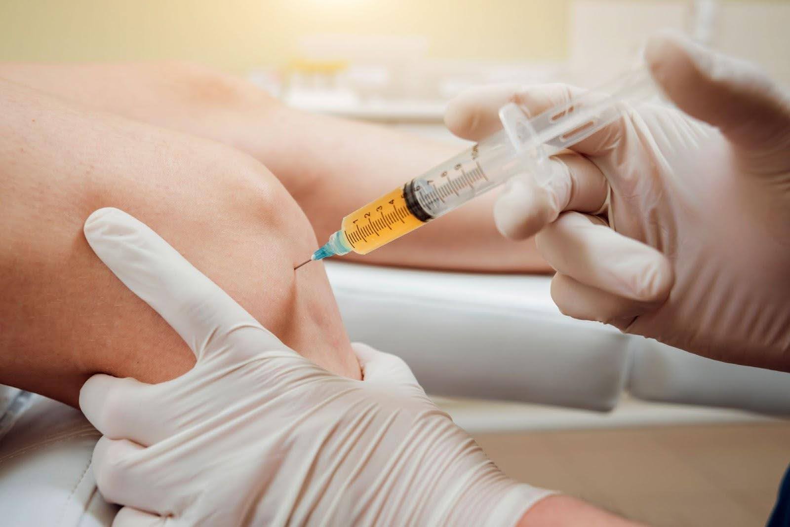 Platelet Rich Plasma (PRP) Injection Singapore