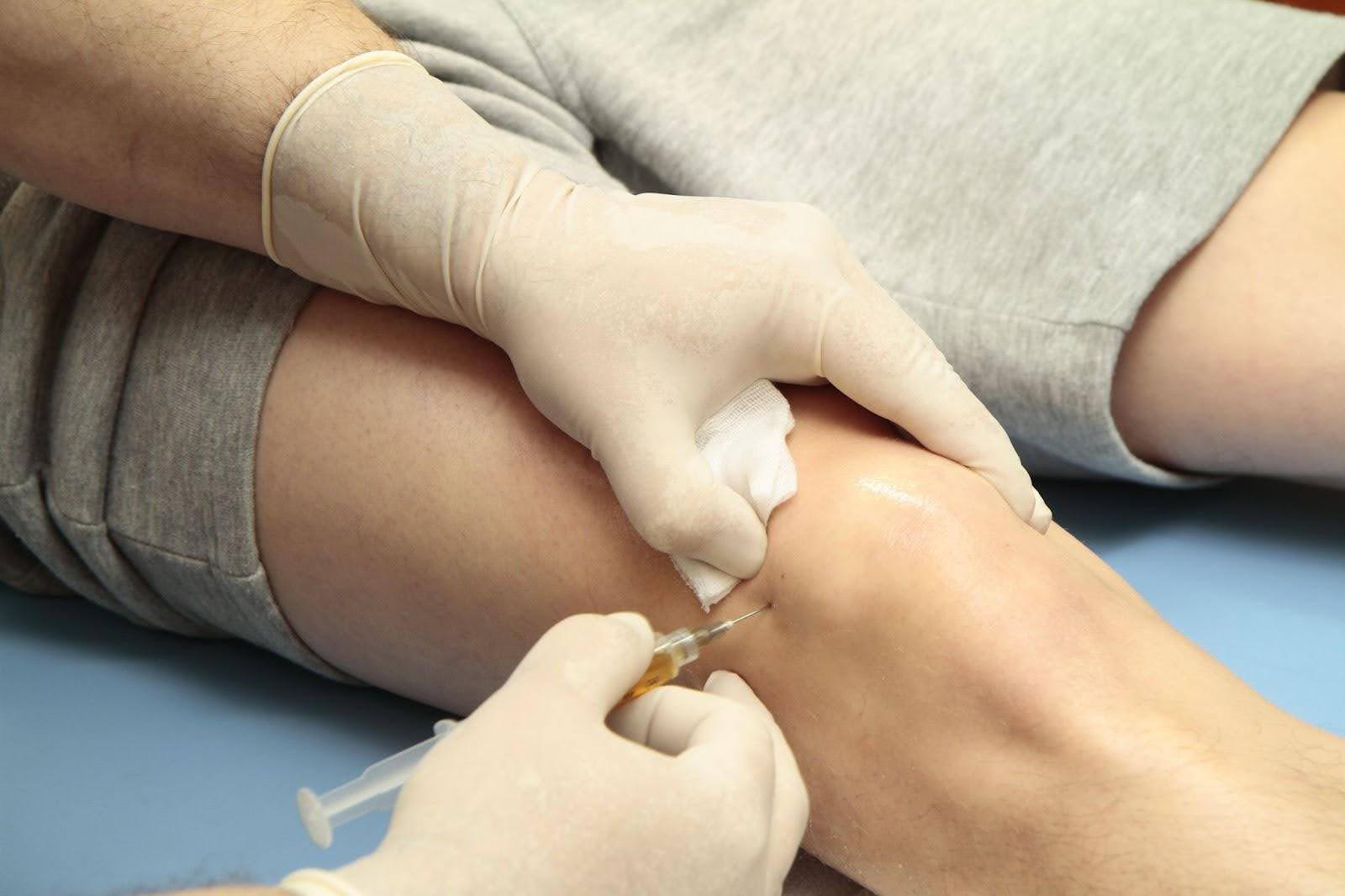 Platelet Rich Plasma (PRP) Injection for Orthopaedic Conditions Singapore