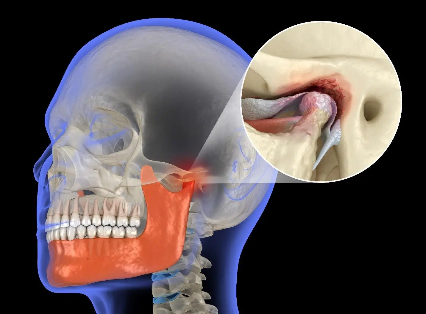 what is tmj pain.